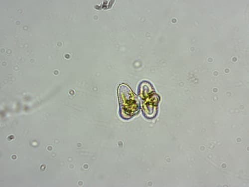 Staurastrum alternans — photo 1