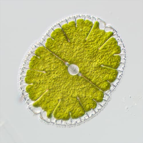 Micrasterias denticulata — photo 1