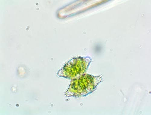 Staurastrum aculeatum — photo 1