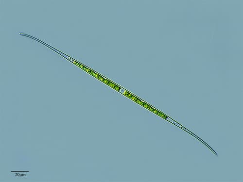 Closterium aciculare — photo 1